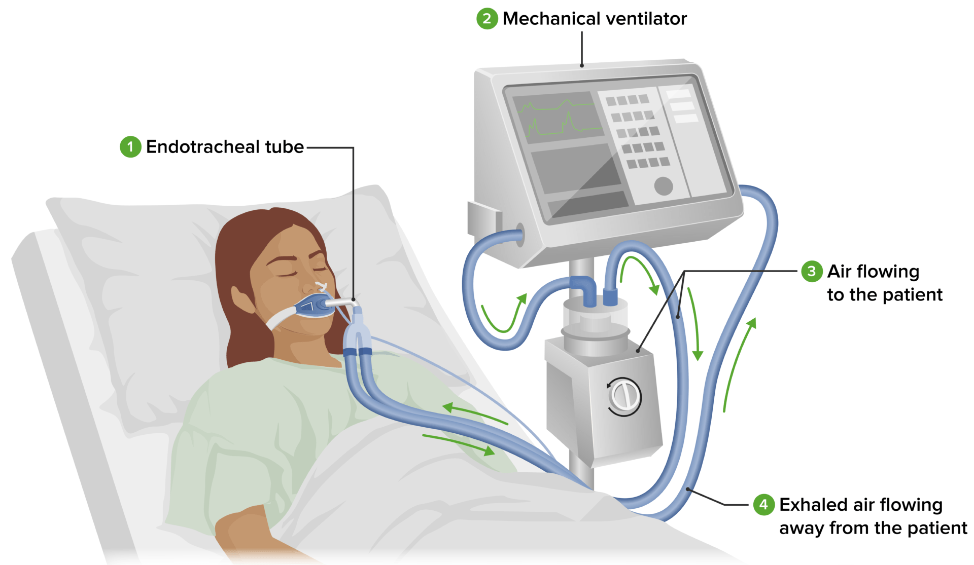 Different Types of Ventilators